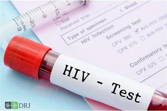 همه آزمایش ایدز بدهید
